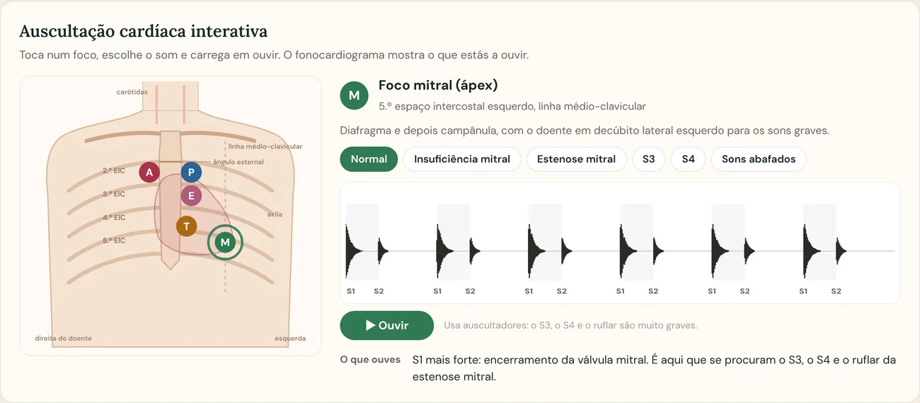 Auscultação interativa da app: Coração normal · foco mitral